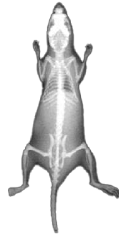 X-Ray